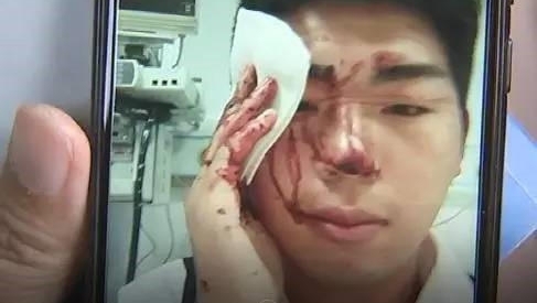�����뱣�����֣��»�֮ҹסҽԺ��̫��ù