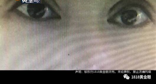Ů�ӻ�1���˫��ƤЧ�����ñ�ȡЦ ����Ժ�ܾ��⳥
