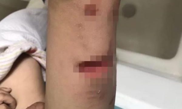 ��������ͨ������˺ҧС�����ˣ�С������ �����ҹ�����