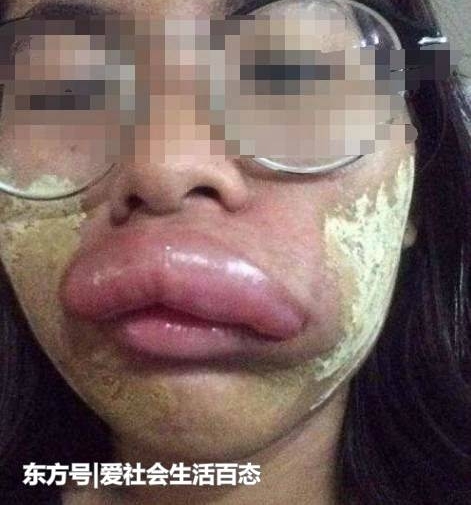 ����ͻȻ����㳦�죬���Ѵ���ȥ��飬ҽ���Ļ������˺�����