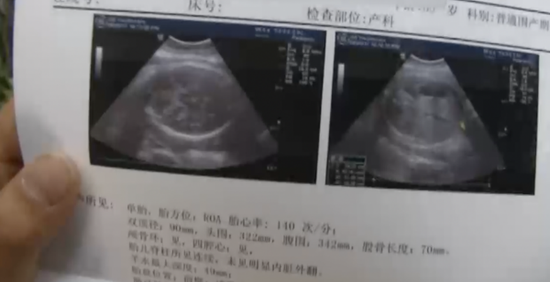 С��ԭ�乲һ�� ���ӱ����߲�֪�ǽ踹����