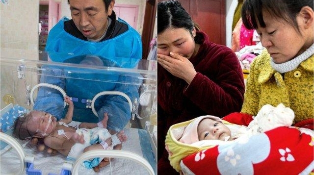 双胞胎姐姐只哭一声便窒息 全家忙筹款任凭田地荒