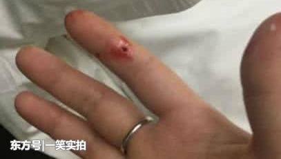 女子醒来觉得不对劲,掀开枕头发现有东西,仔细一看吓得赶紧喊人