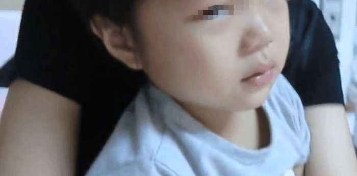 孩子患上口腔癌舌头被切除 只因家长常常给孩子吃这个