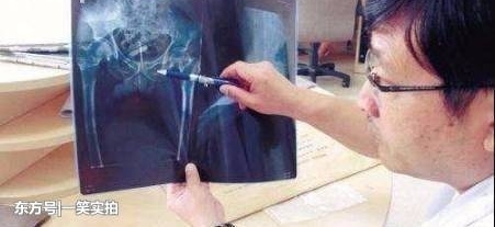 Ů��18���δ���������裬ҽ���������Ŀ���ʱ�������˶�������