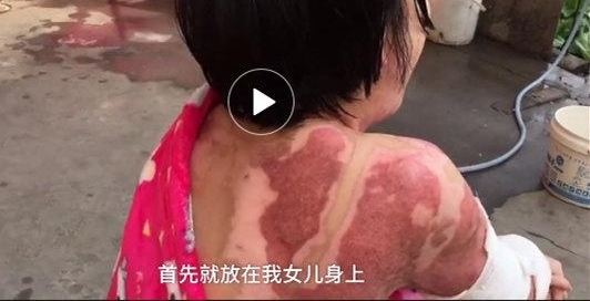 ��ݸ16����Ů��ǰ������ú������ ǰ����������������һ��