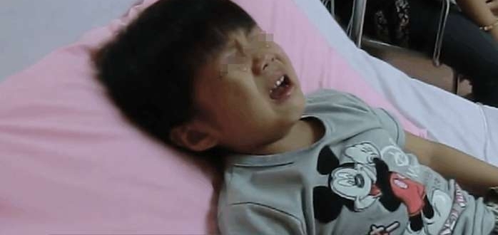 孩子患上口腔癌舌头被切除 只因家长常常给孩子吃这个