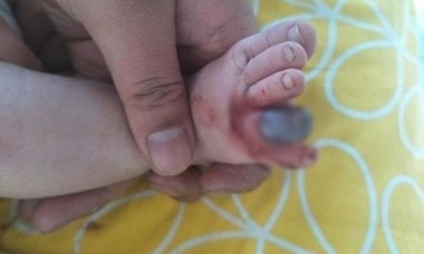 ���ḸĸҪע�������ⶫ������ֺ�������´�Ӥ����Ҫ��֫��