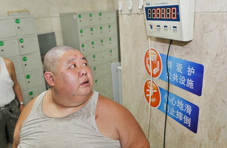 重庆男子体重342斤 老婆嫌弃离家出走