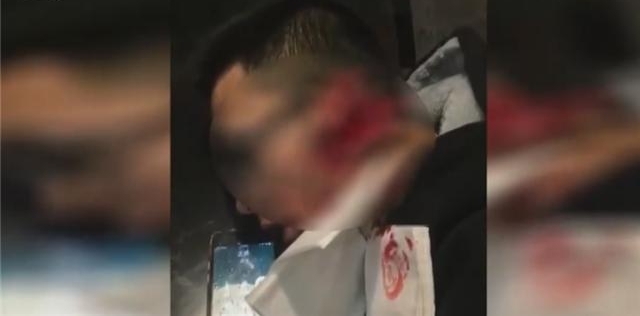 男子与网友起口角后线下约谈 不料遭人埋伏耳朵被砍断