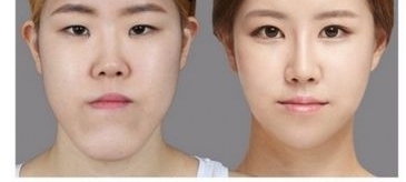 妙龄女子登机遭拒 安检人员:快来!这里有个整容的!