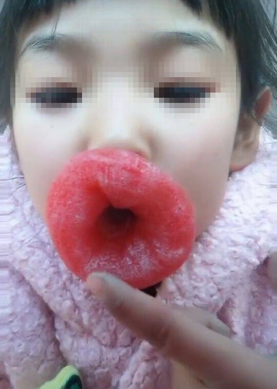 小女孩被逼做一事后嘴唇奇肿无比,真相让人捧腹大笑却又担忧不已