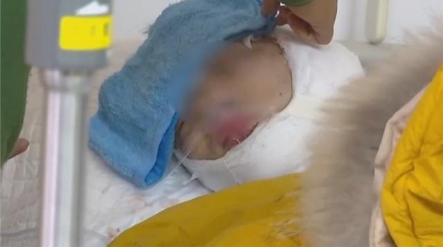 男子与网友起口角后线下约谈 不料遭人埋伏耳朵被砍断