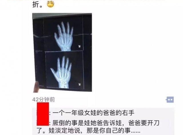 第一批 80 后已经被 00 后气死!一写作业鸡飞狗跳!