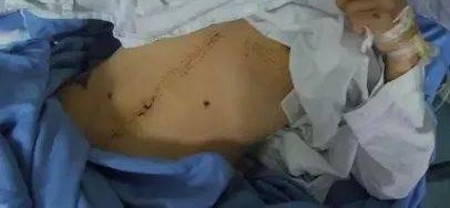 ���ϣ�������Ӽ����Ĺ��ж���7�ּ�֢�������ڿ��������Ŵ�
