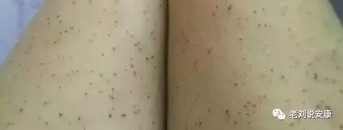 时而像伤口撒盐,时而像蚂蚁噬咬,旬阳女子莫名腿疼4年