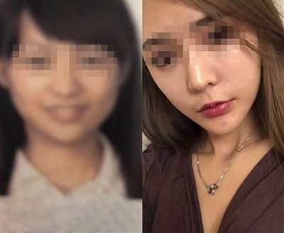 妙龄女子登机遭拒 安检人员:快来!这里有个整容的!