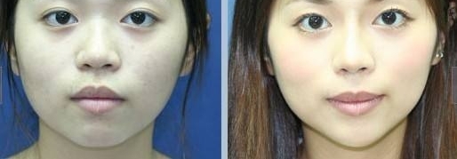 妙龄女子登机遭拒 安检人员:快来!这里有个整容的!