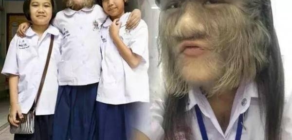 泰国毛脸小女孩长大了,脸上无毛,还有了陪伴的人