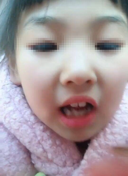 小女孩被逼做一事后嘴唇奇肿无比,真相让人捧腹大笑却又担忧不已