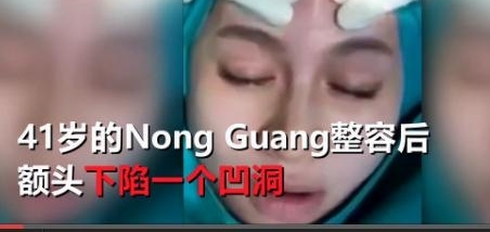 男子整容失败,暴打医生被抓只为了追心仪美女?