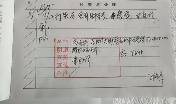 ����У԰���裬����ܺ�����һ��15��Ĳм�Ů��