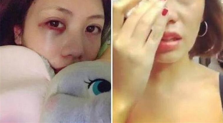 女子因网购投诉遭卖家上门殴打 否认自己是“专业差评师”