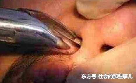 ����3�����¶�������Ѫ��ҽ��������������γ�һ������