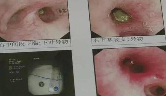 8���к�͵�������̲� �������һ����4�η���
