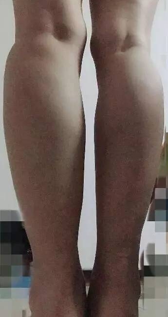 95��Ů����������20��󹫿���������������˹���ʧȥ����