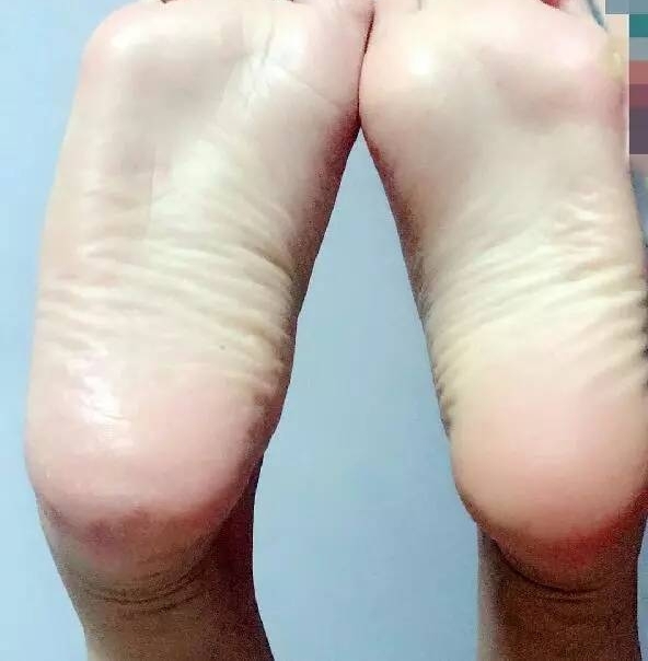 95��Ů����������20��󹫿���������������˹���ʧȥ����