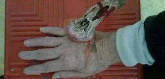 ÀÏÈËÊÖ±³³¤³öê÷½Ç£¬¼ÒÈË·×·×˵Êdz¤Êٽǣ¬ÀÏÈËÈ´ÃæÁÙÉúÃüΣÏÕ£¡