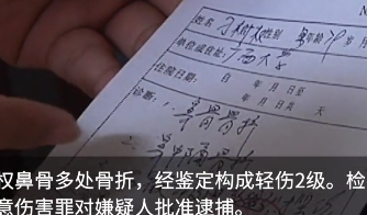 79岁老教授劝阻吸烟被打至骨折,眼睛当场失明,打人者:我没错