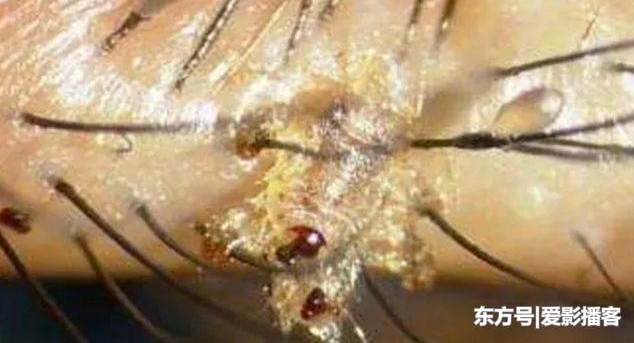 Ů���۽�ë����200���������棬ȥҽԺ����ԭ��ȴ��������