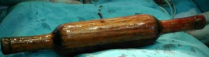 Ů�Ӹ�ʹȥ��ҽ��������ʱ���з���38���׳���ߦ���ȣ����Ǿ���