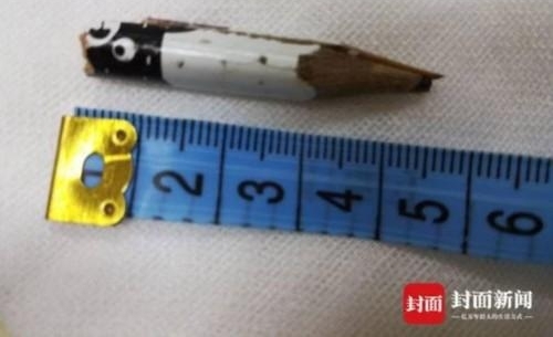 Ůͯ��Ǧ�ʲ���������ǻ ҽ��ȡ��4.5cm��������