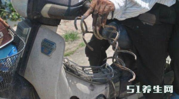 Խ�ϴ���35�겻��ָ�ף�Ϊ�˲�ϴ�衢�����ӷֿ�˯��