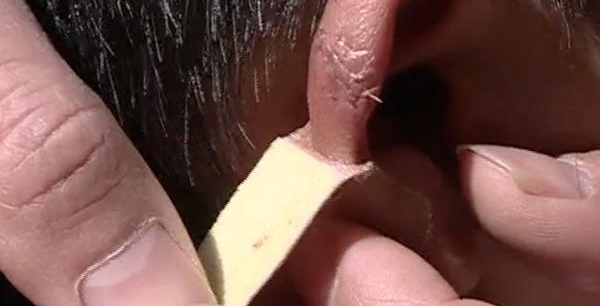 8����ͯ������ʦ���˶��������� �ҳ����⳥���