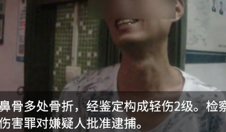 79岁老教授劝阻吸烟被打至骨折,眼睛当场失明,打人者:我没错