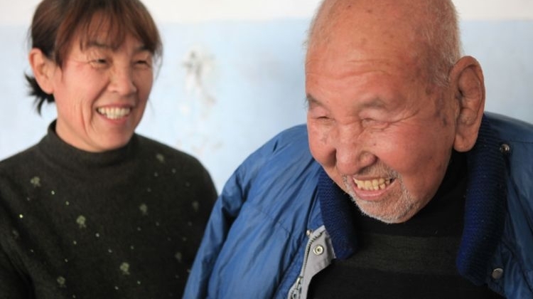 89岁老人耳朵有常人的两个大,老人耳朵为何如此之大?没人知道
