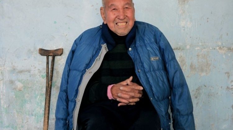 89岁老人耳朵有常人的两个大,老人耳朵为何如此之大?没人知道