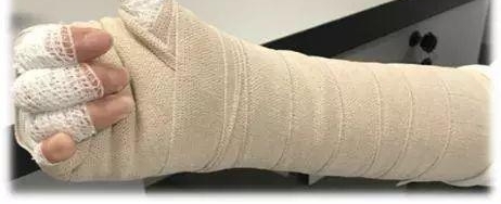 ����Ů�����ֱ۱����Ӷ�һ�ں󣬾�Ȼ��񡰷�������