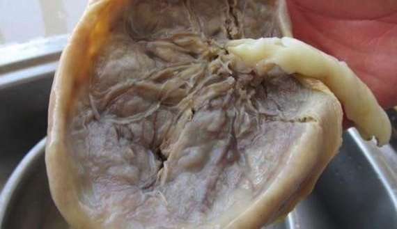 生完孩子后,亲妈一定要她把胎盘吃了,这些说法让她想骂人