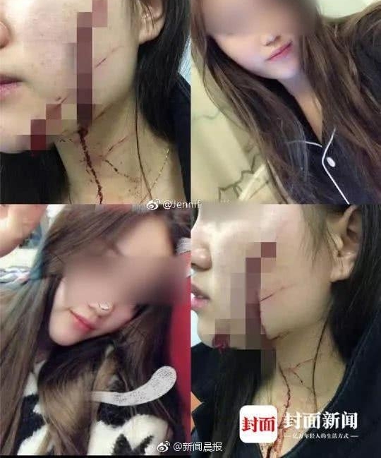 ���£�18��Ů������������Ѵ��ص����ӿ�����