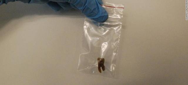 FBIͨ��DNA���� �⿪��һ��4000��ľ�������ϵ�����