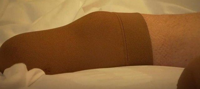 男子感染罕见流感并发症 被迫截去双脚和 9 根手指