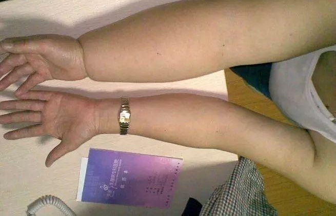����Ů�����ֱ۱����Ӷ�һ�ں󣬾�Ȼ��񡰷�������