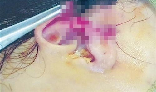 课堂上学生将老师打成脑震荡 原因是“靠得太近”
