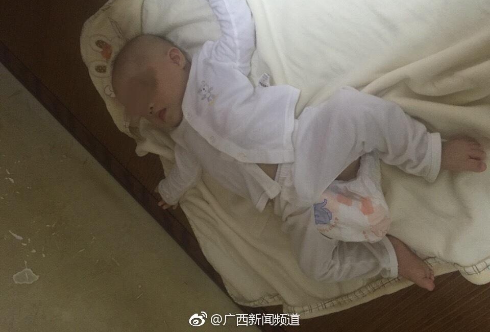 南宁:狠心父母将疑似唐氏综合症女婴遗弃医院过道