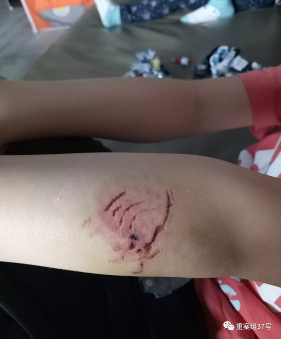 ����������ͯ����ҧ�� ������ץ��10��������Ȯ